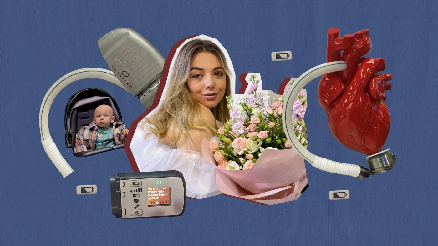 Ольга Клюбова з немовлям, моделлю серця та апаратом HeartMate 3